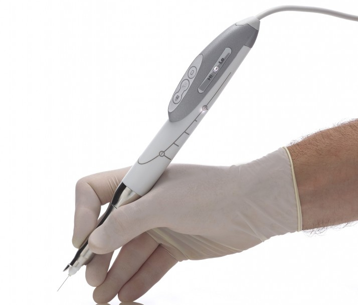 Dentiste annesthésie sans douleur